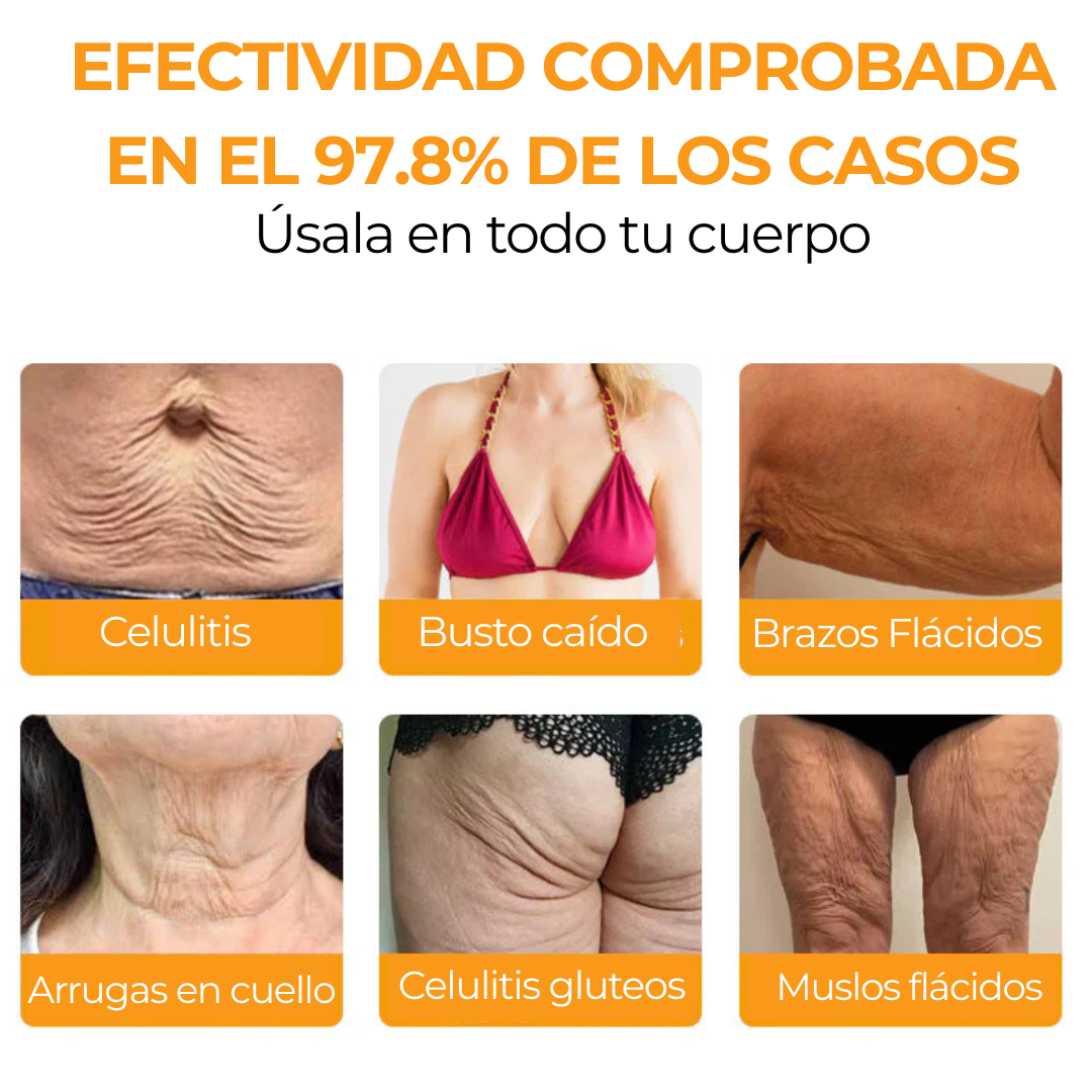 Hecho en EE. UU. ✨ Crema restauradora de la piel con veneno de abeja BeeVenom BsWell® ⏰ ÚLTIMO DÍA CON REGALO